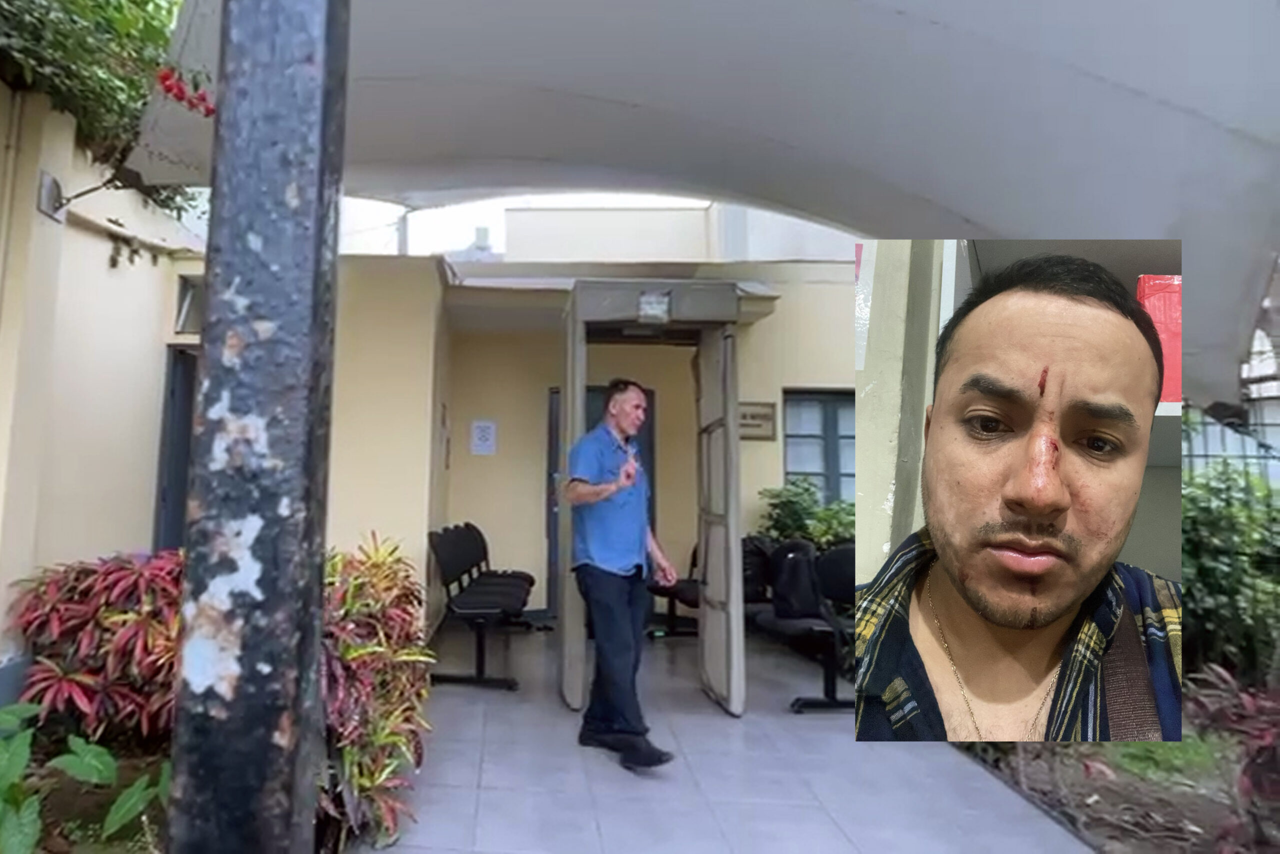 Lima: Camarógrafo de PBO es agredido en exteriores de la Embajada de México